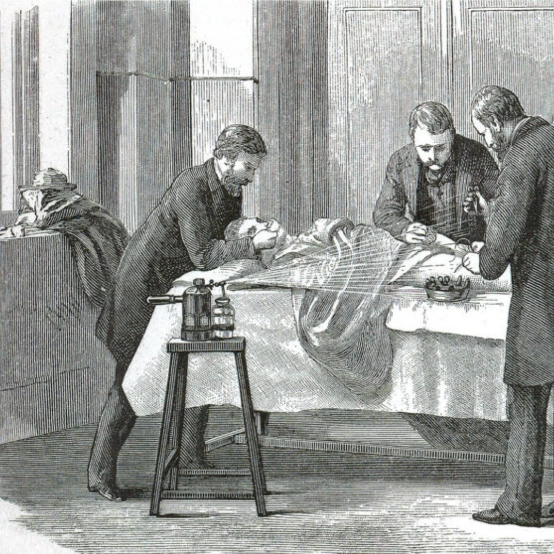 Throwback Thursday: Surgery in the late 1890s had a 50% mortality rate, most deaths being the result of infection. Dr. Joseph Lister, after seeing remarkable positive results on carbolic acid cleaning wounds, began to sterilize surgical instruments w