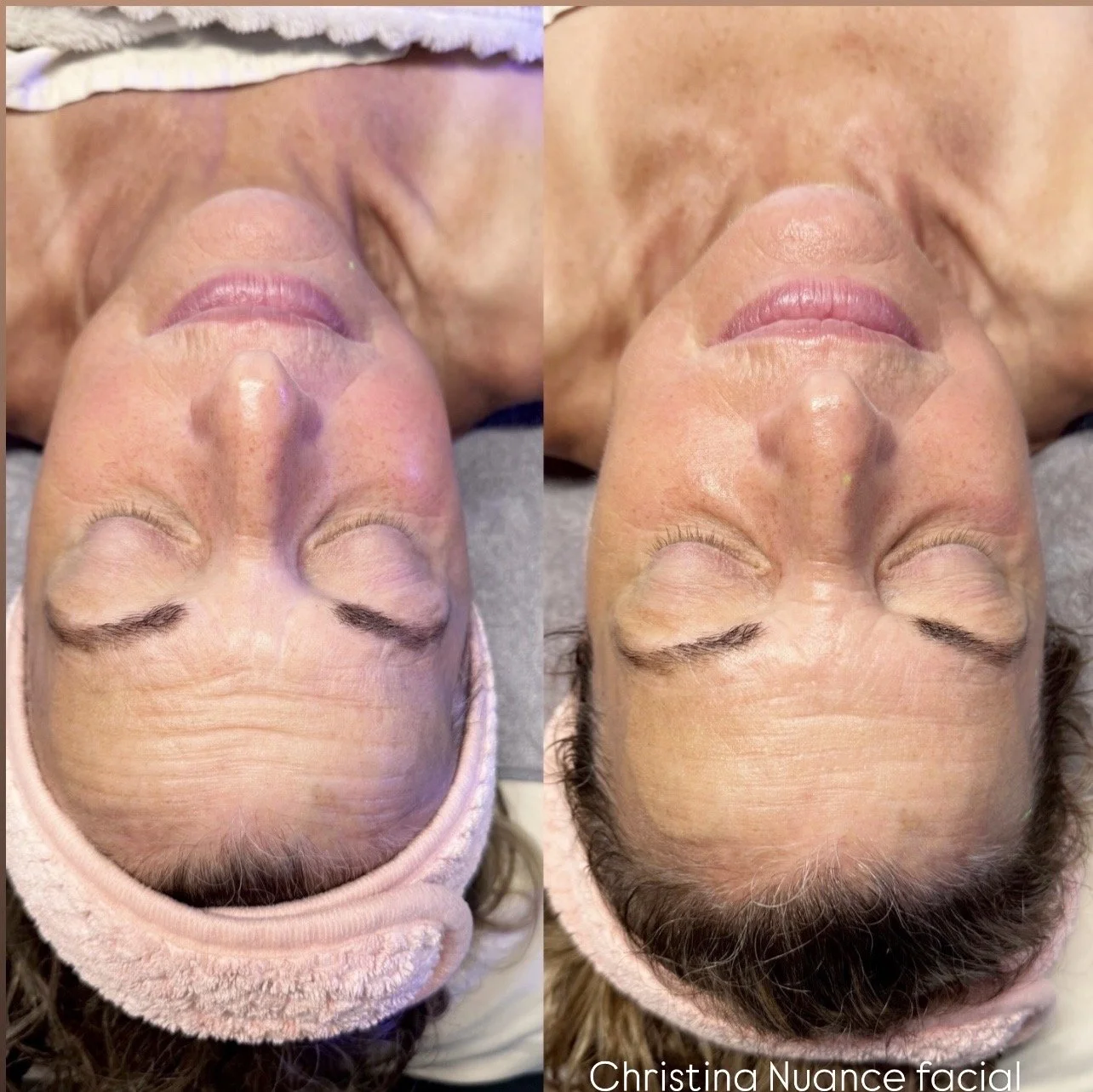 Nuance anti-aging