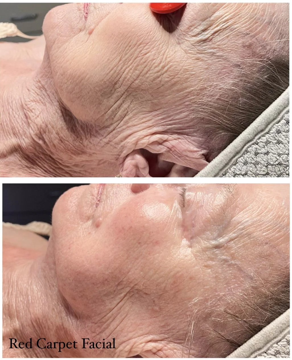 Red Carpet facial
