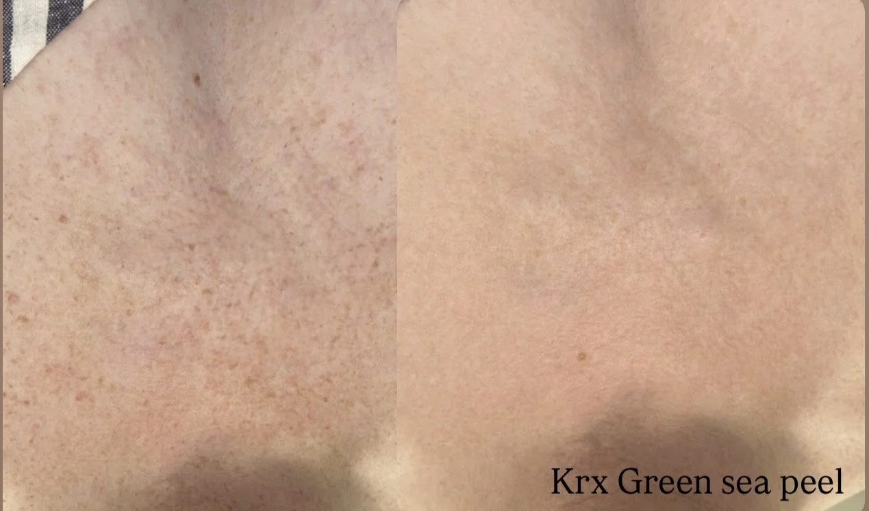 Korean green sea peel