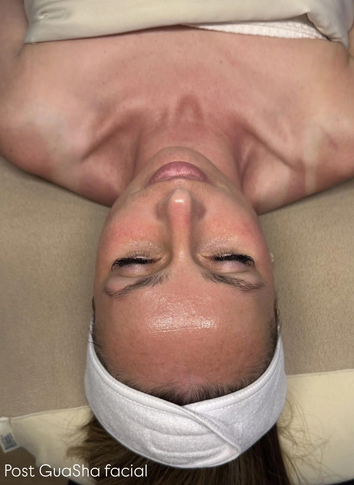 post Gua Sha facial
