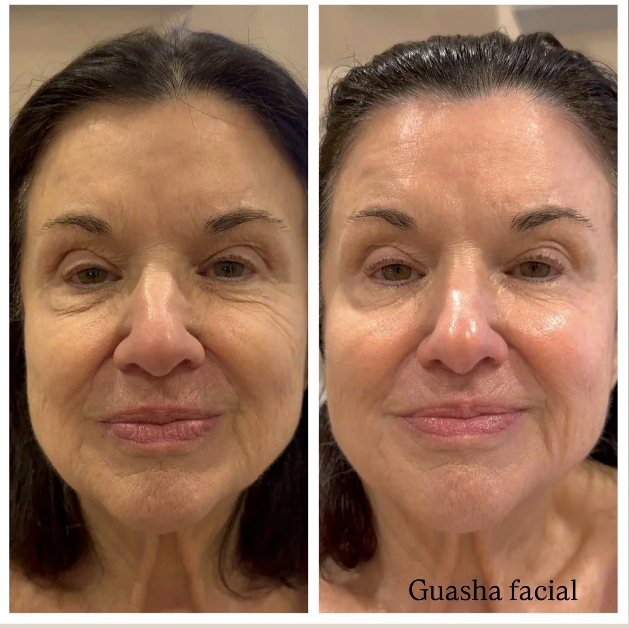 Gua Sha facial