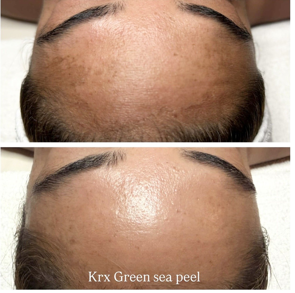 Korean green sea peel