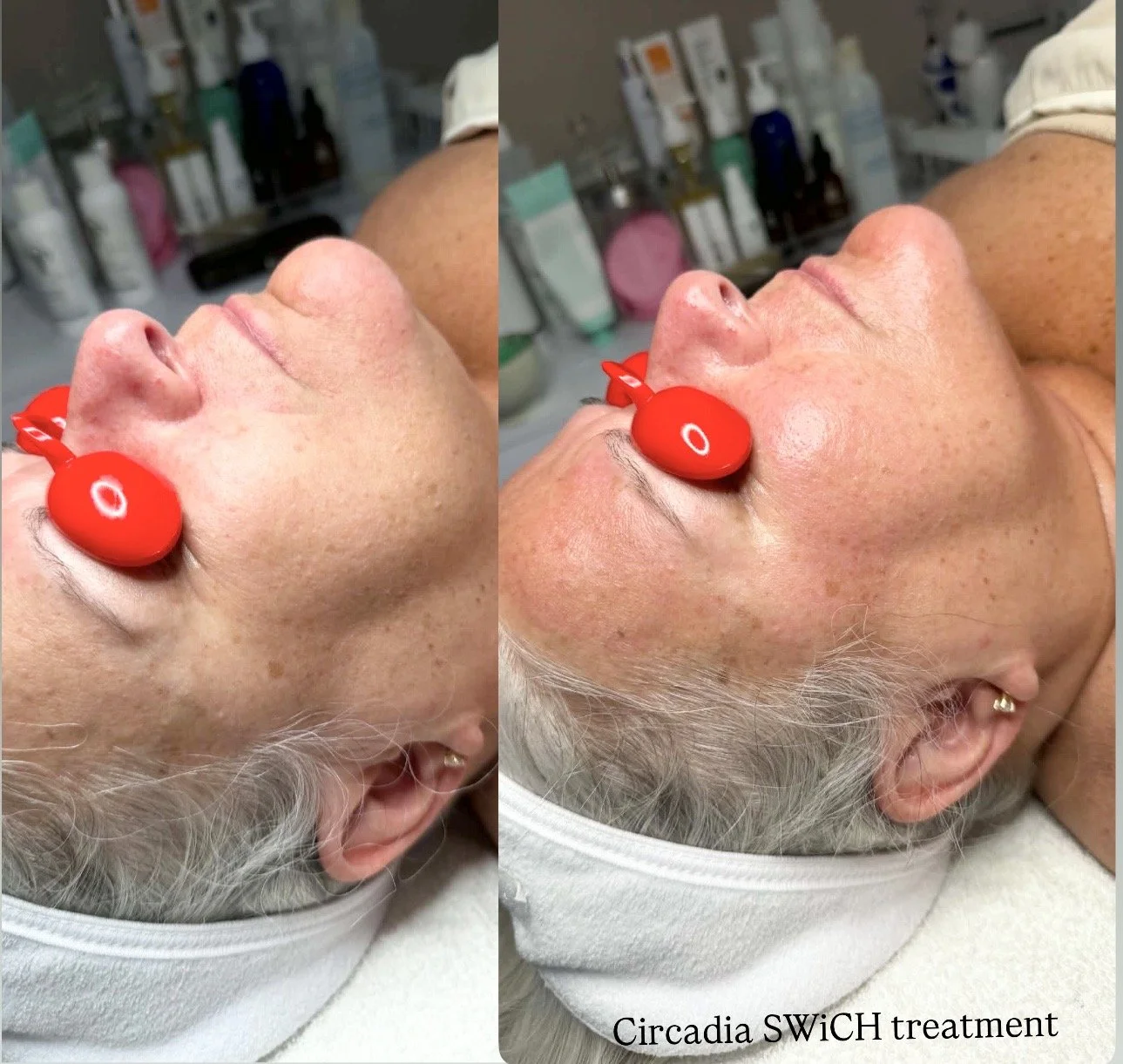 Circadia SWICH peel