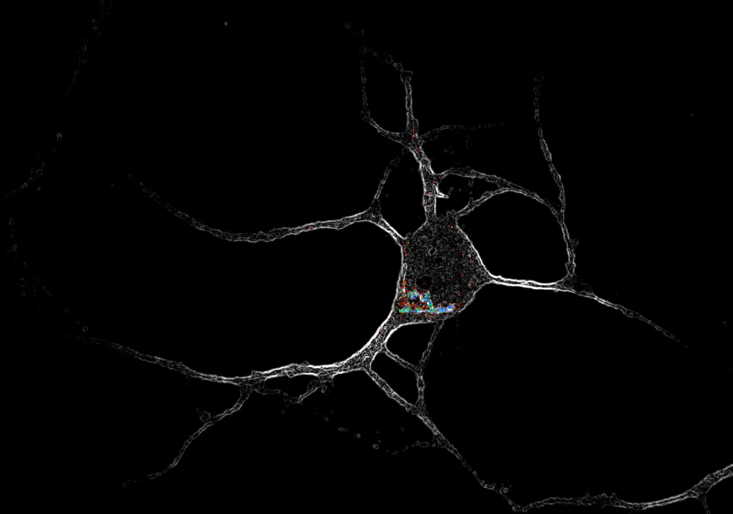 Microscopic image of a neuron with branching dendrites on a black background