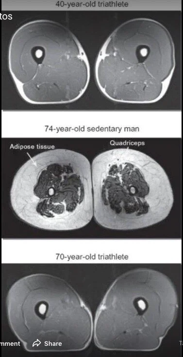 Triathlete brain