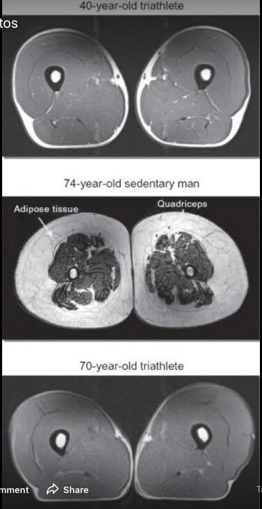 Strength is often forgotten and sarcopenia