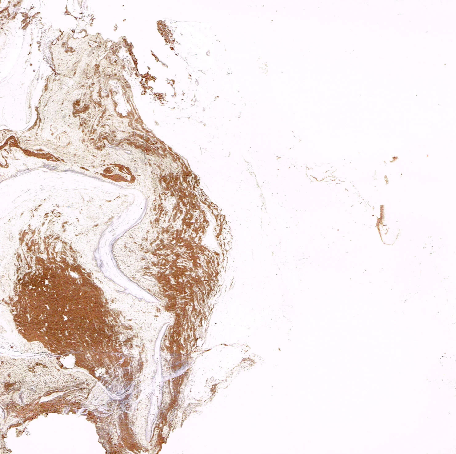 Scan_Marble02_edit.jpg