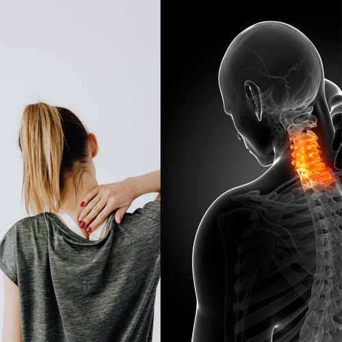 5 Reasons Why a Strong Neck is Important — Svelte Training