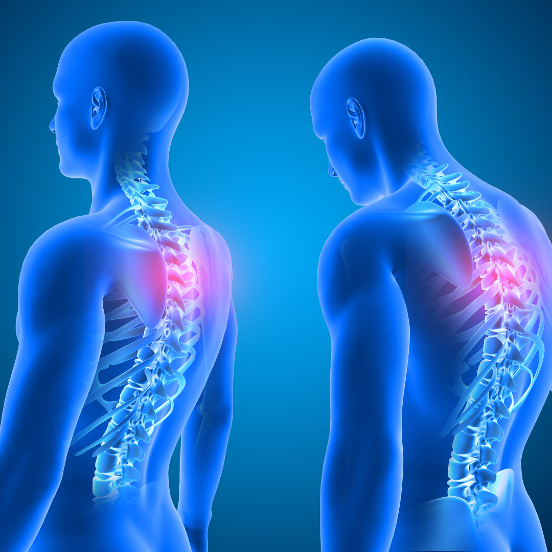 5 Reasons Why a Strong Neck is Important — Svelte Training