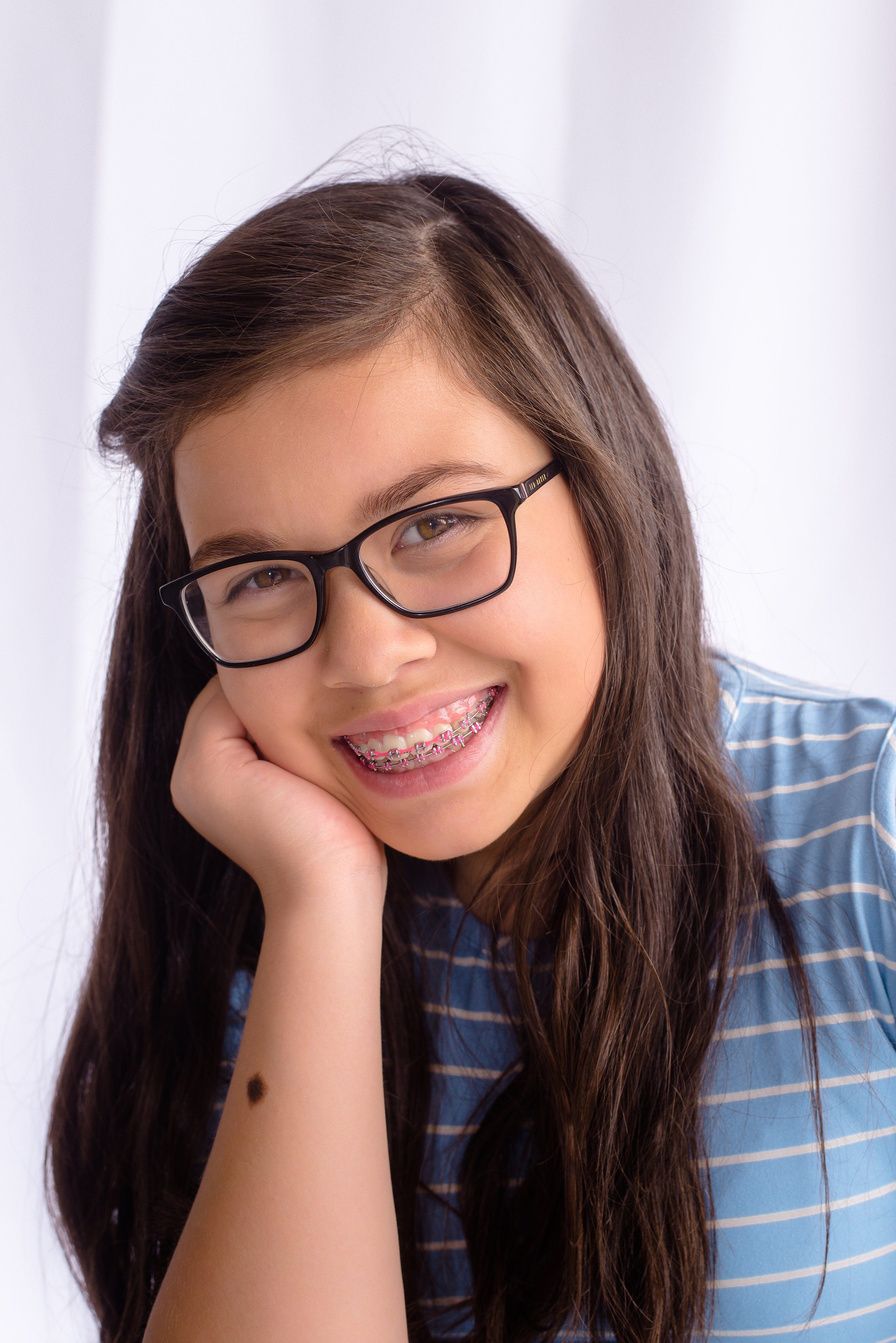 Rubber Band Wear - Orthodontist Vancouver WA