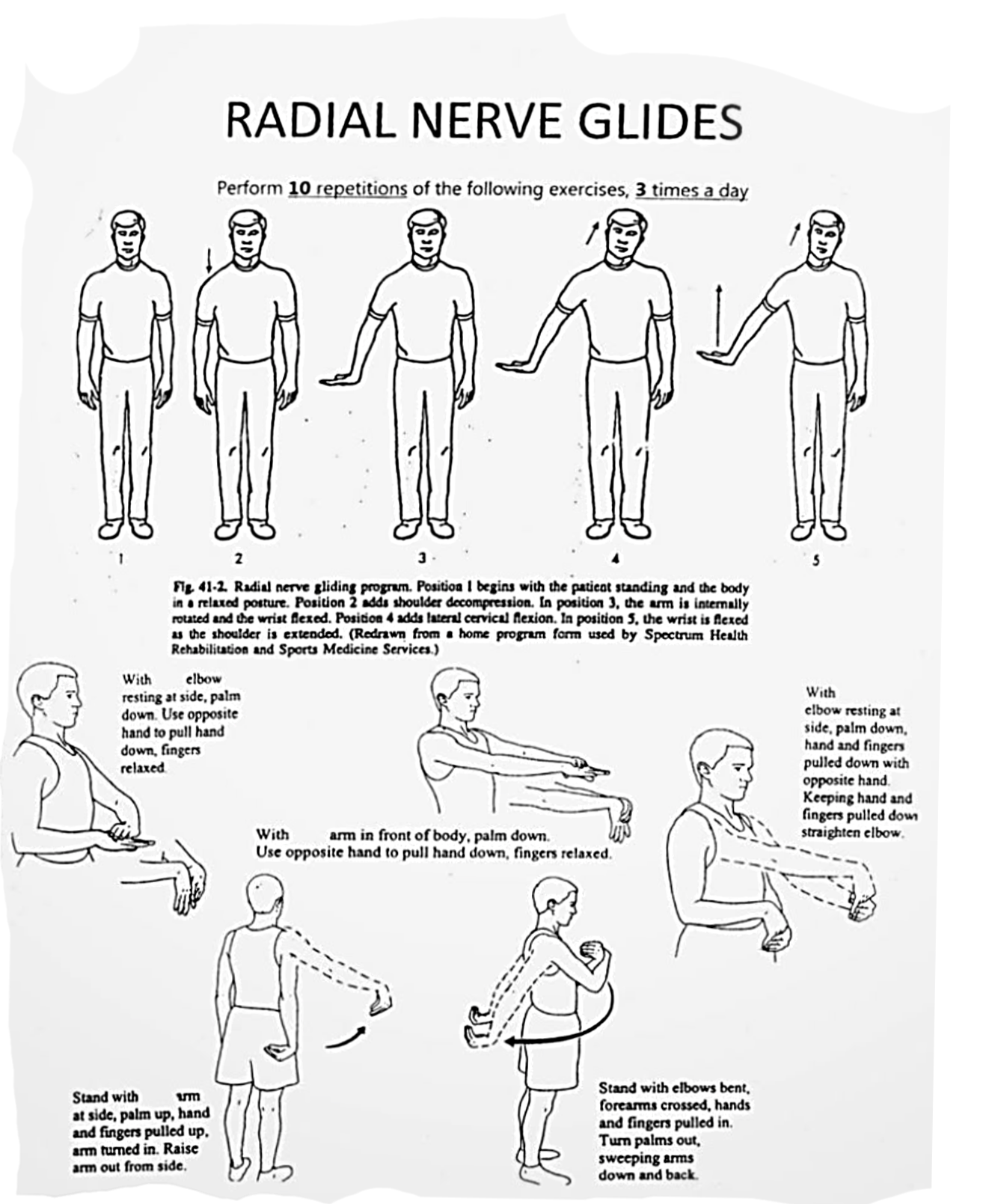 Why Floss More Than Just Your Teeth: The Radial Nerve