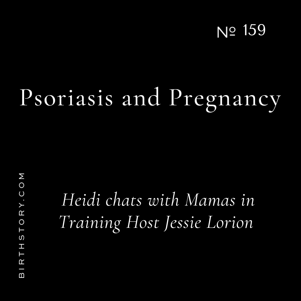 159 Psoriasis and Pregnancy. The Story Behind Mamas in Training Host Jess Lorion