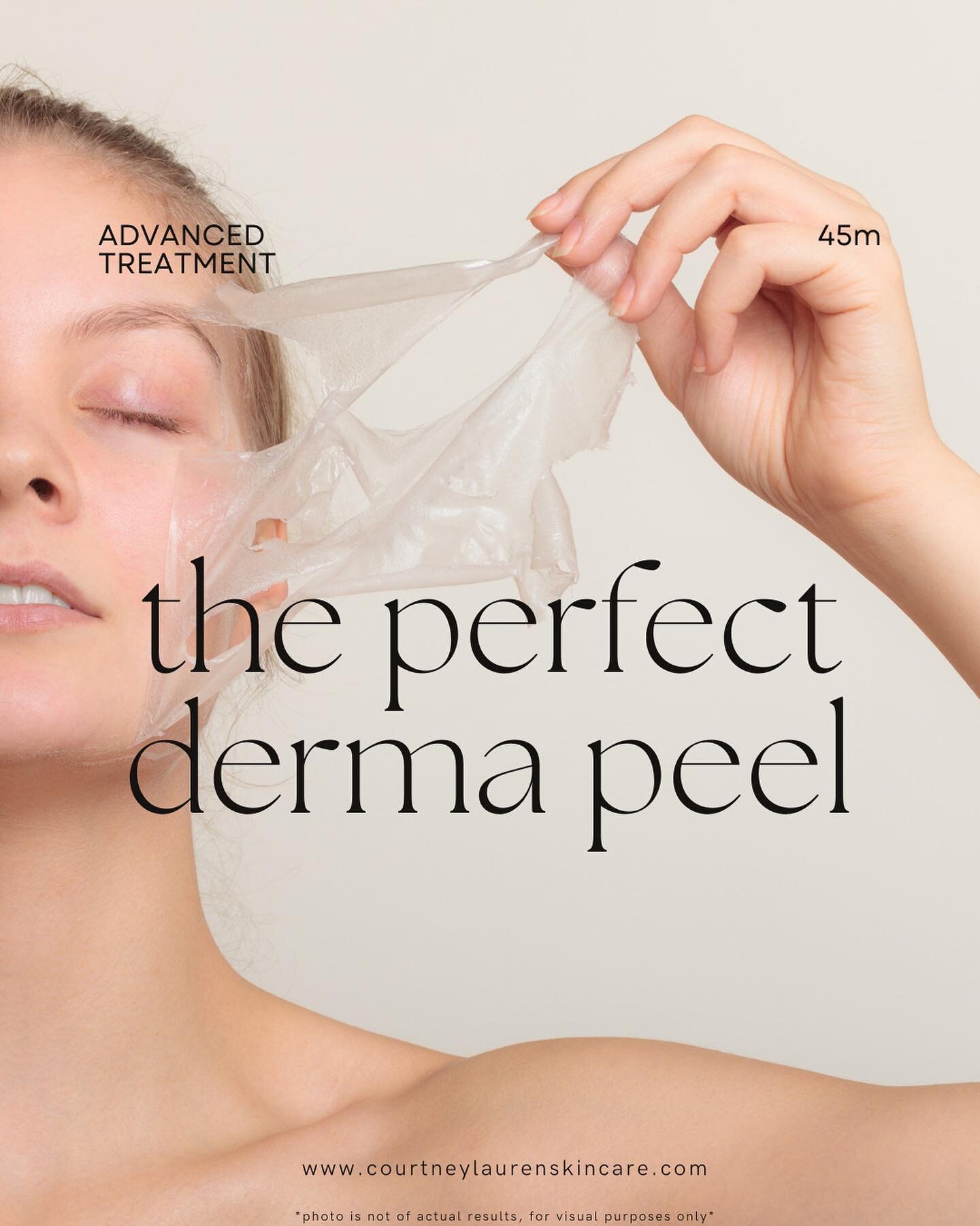 Real results featuring @The Perfect Derma Peel
⠀⠀⠀⠀⠀⠀⠀⠀⠀
It&rsquo;s peel season!! The Perfect Derma Peel combines powerful ingredients with effective acids to deliver outstanding results. 
⠀⠀⠀⠀⠀⠀⠀⠀⠀
Our client has had 3 perfect derma peels (spaced ap