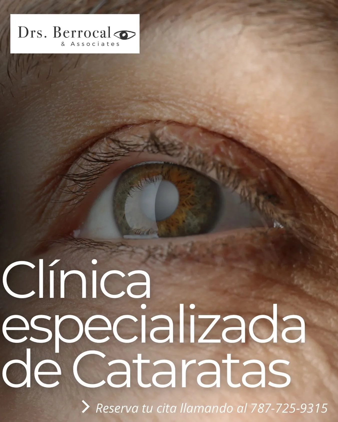 ¿Tienes cataratas? ¡Ven a nuestra clínica exclusiva de cataratas y obtén un tratamiento completo! 👁️🇵🇷
📞787-725-9315