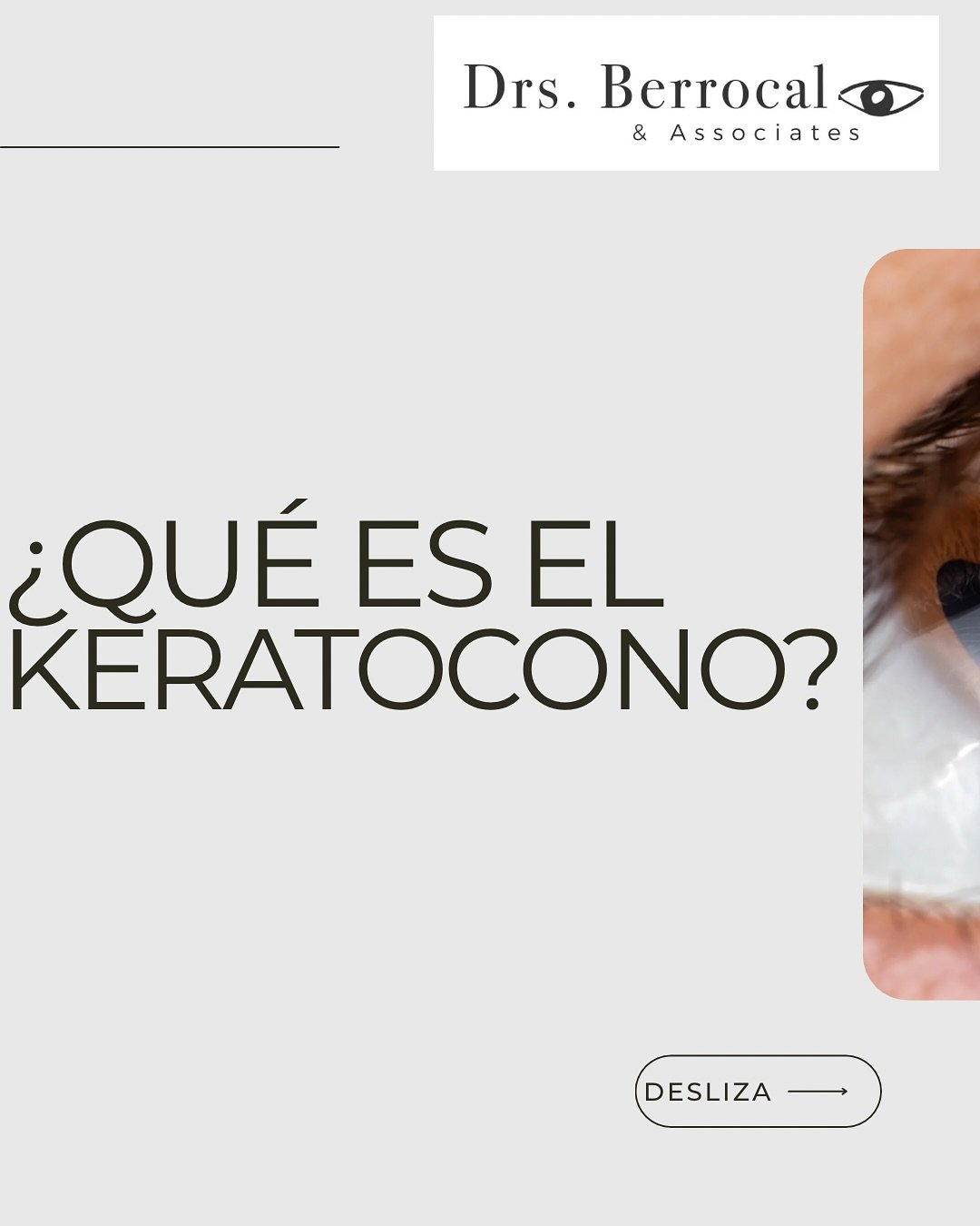 🌍 Hoy conmemoramos el D&iacute;a Mundial del Queratocono, una condici&oacute;n ocular que afecta la forma de la c&oacute;rnea y puede distorsionar la visi&oacute;n.
En Drs. Berrocal &amp; Associates nos unimos a esta iniciativa para crear conciencia