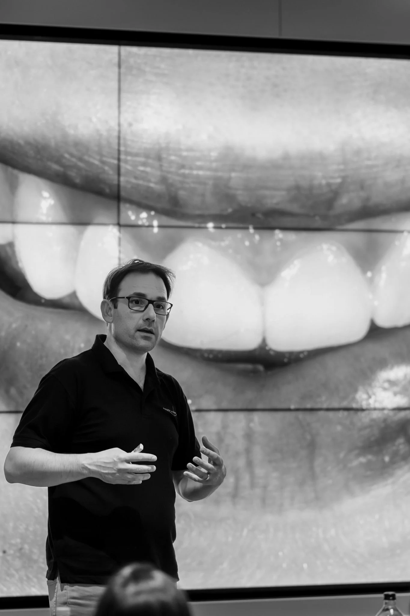 Prosthoworks_toothwear_march13th-67.jpg