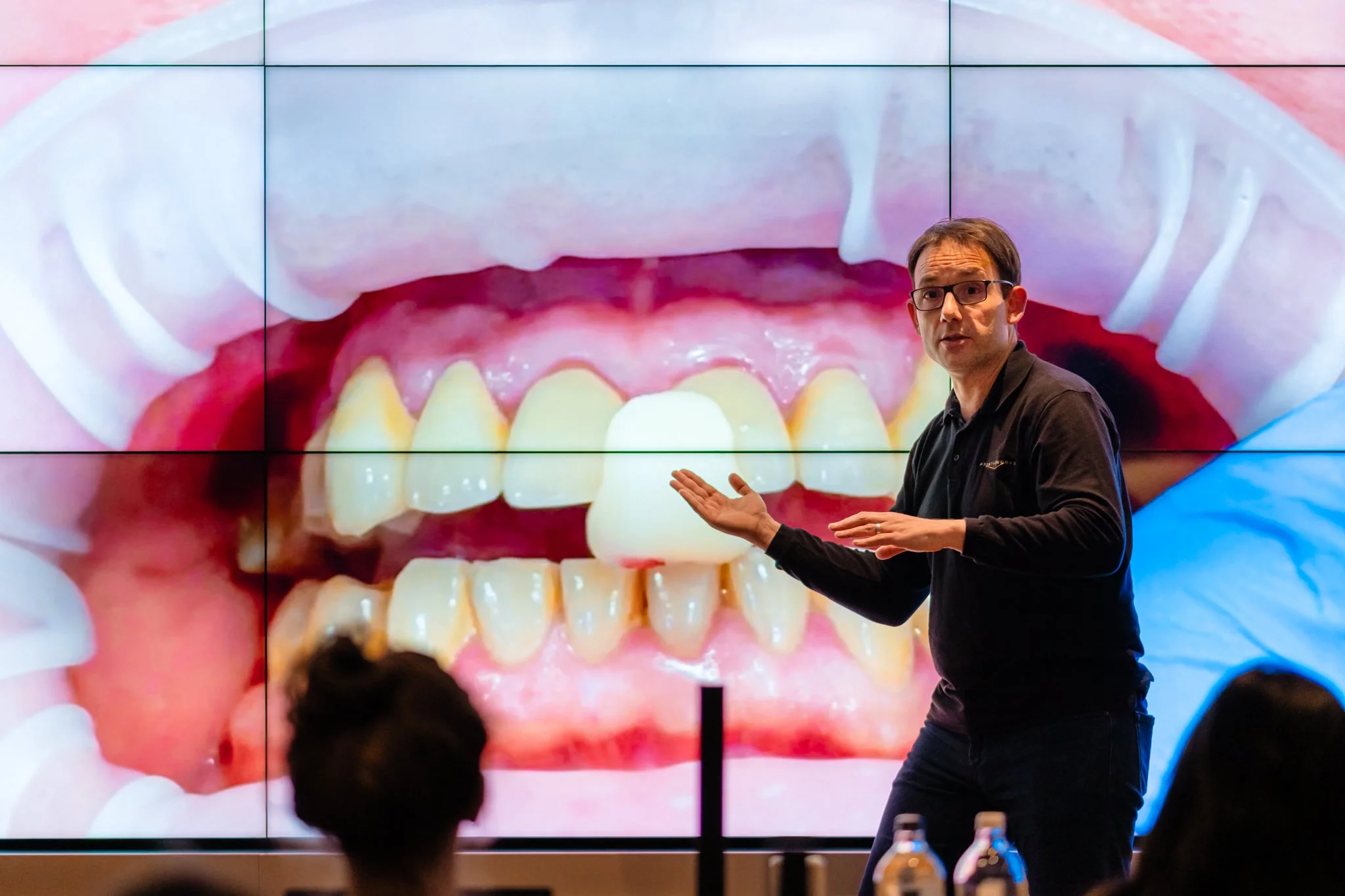 Prosthoworks_toothwear_march13th-94.jpg