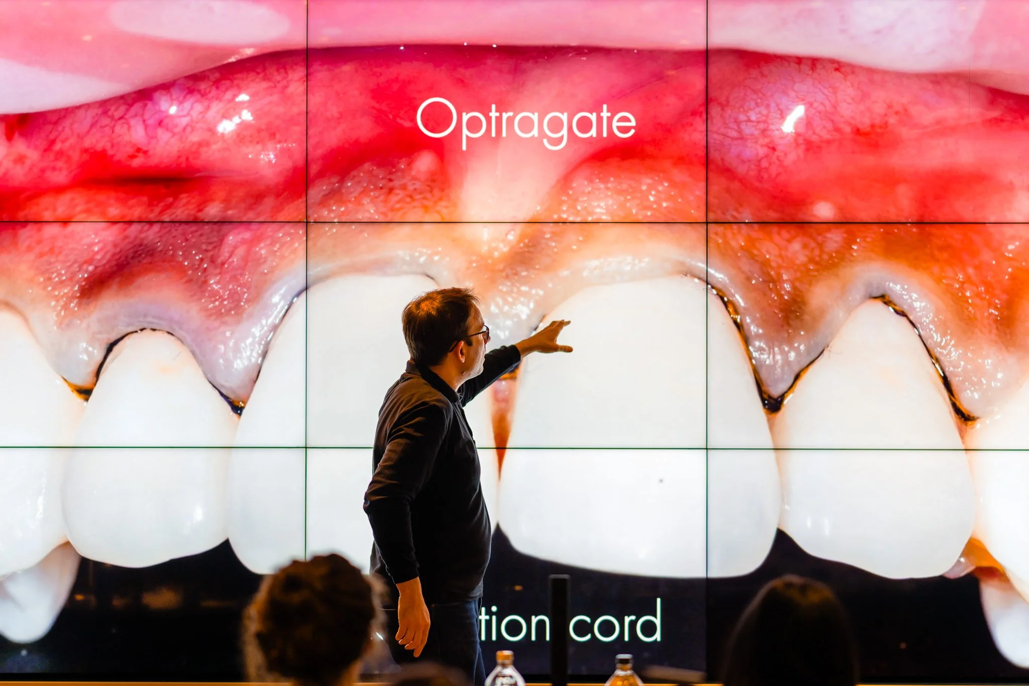 Prosthoworks_toothwear_march13th-150.jpg