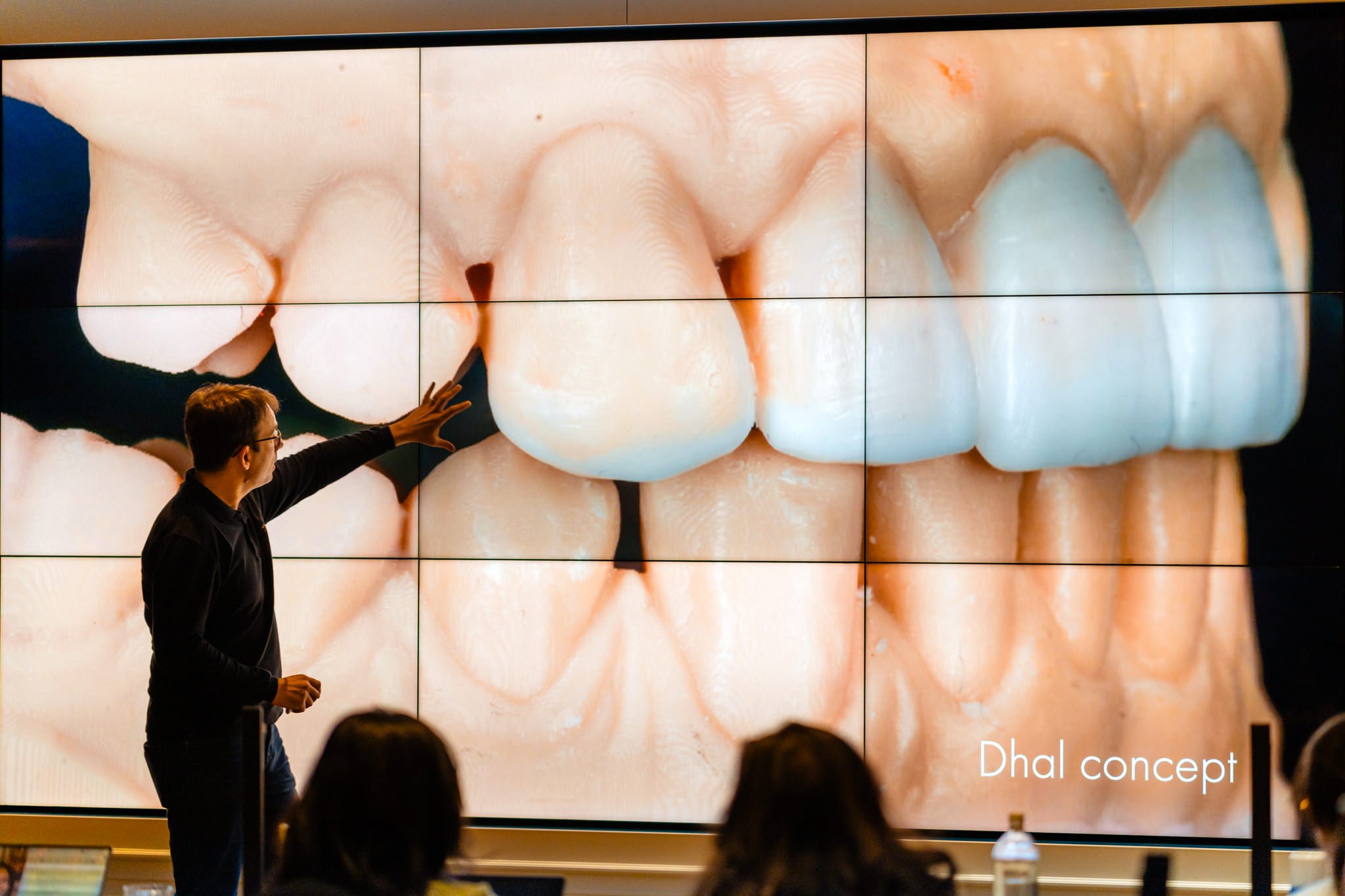 Prosthoworks_toothwear_march13th-72.jpg