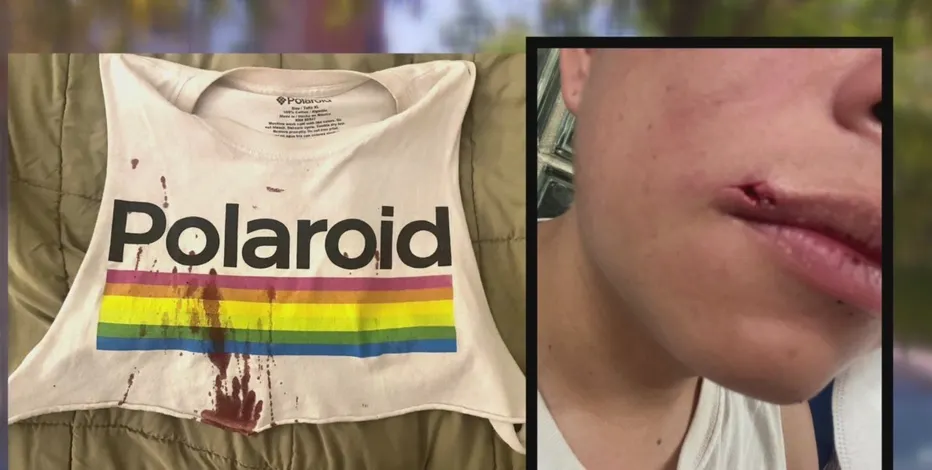 August 9: Two gay men in Washington, DC physically assaulted and targeted with anti-gay slurs &amp; references to mpox