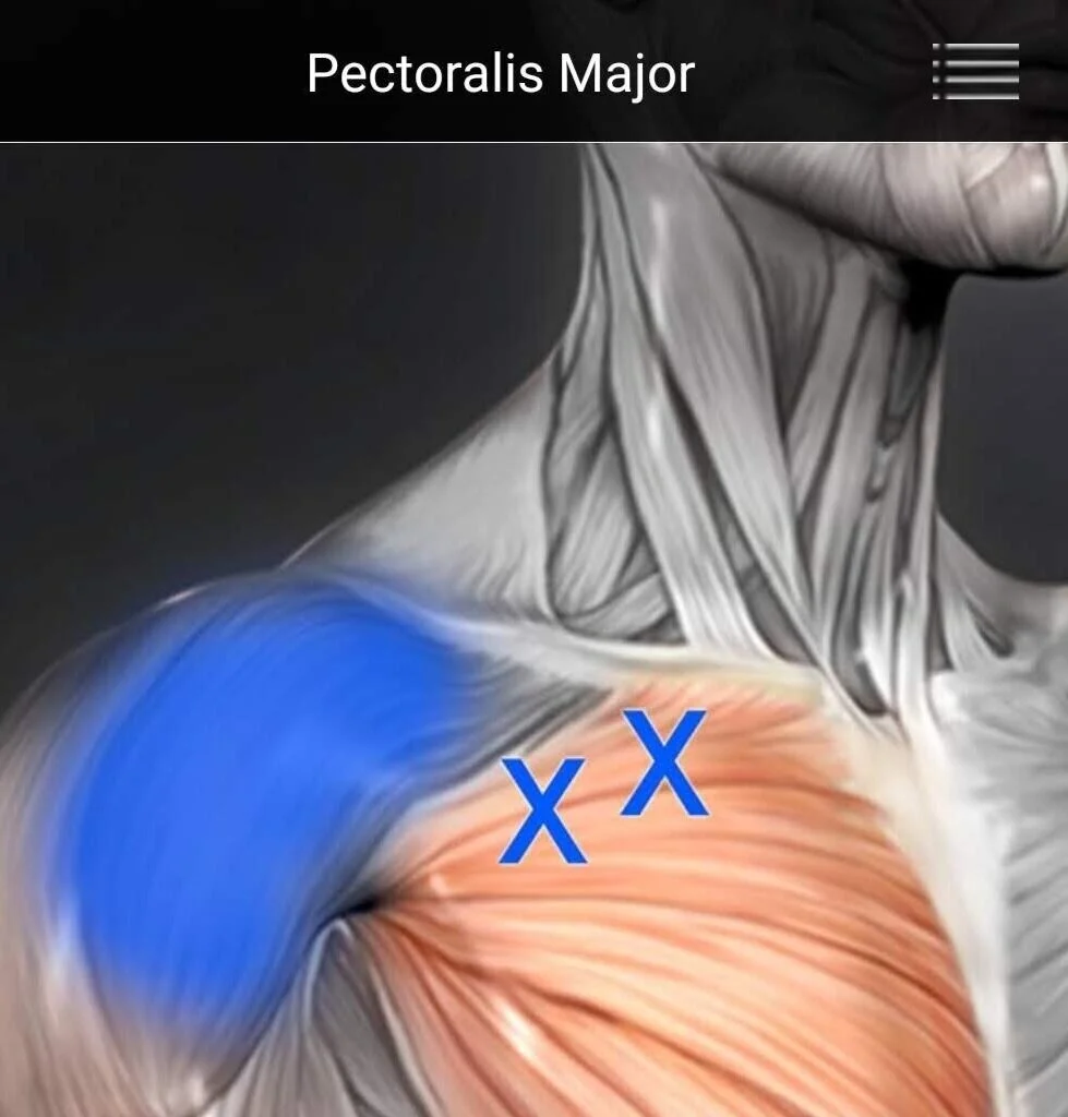 Screenshot_20190402-202103_Muscle+Trigger+Points.jpg