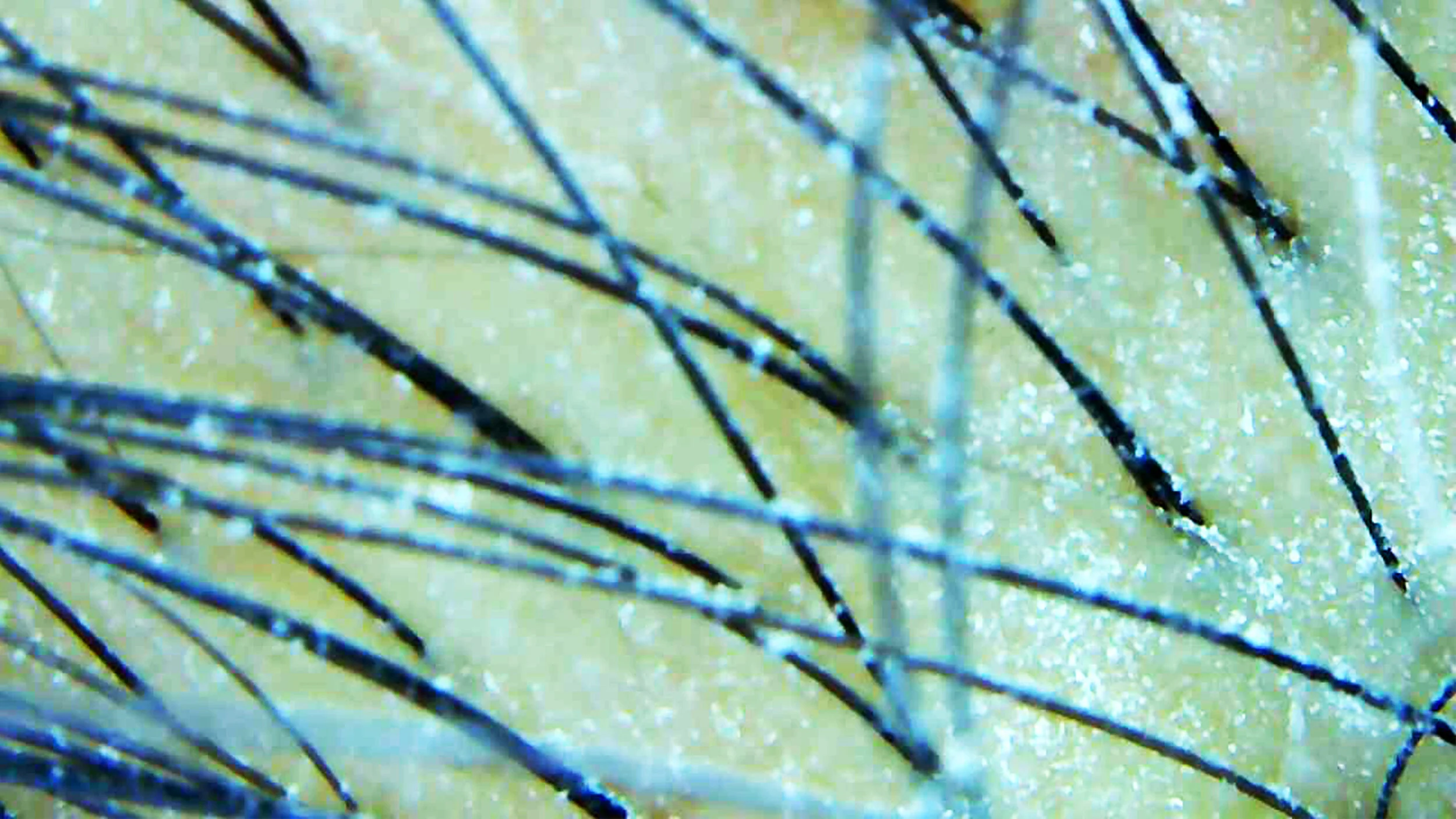 Aerosol Scalp.jpg