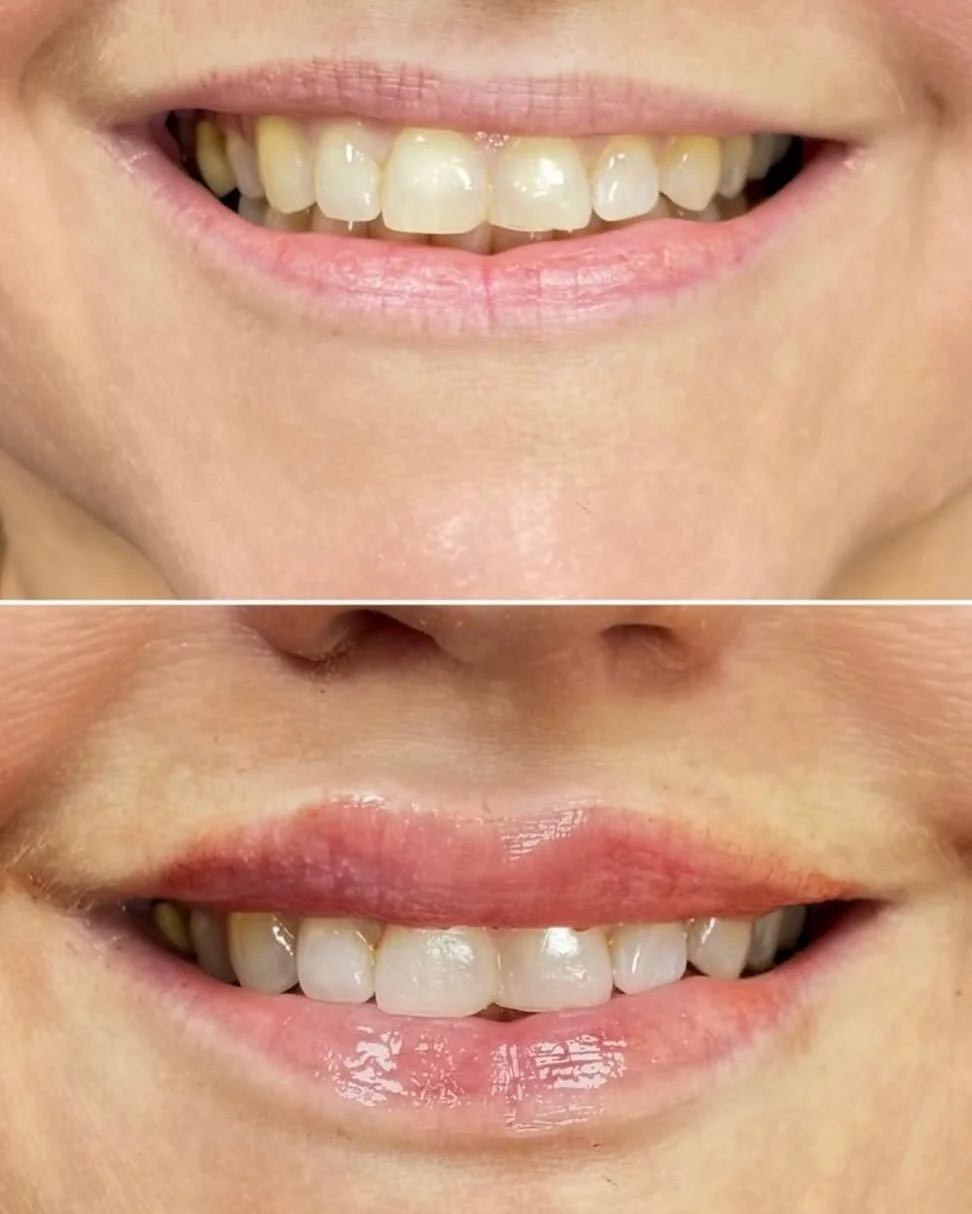 This is your reminder that Megan is visiting us on April 18th and spots are filling up fast. 

GMC registered and seriously talented, Megan offers: Anti-wrinkle injections, botox, dermal filler and specialised nose filler

Whether you&rsquo;re a firs