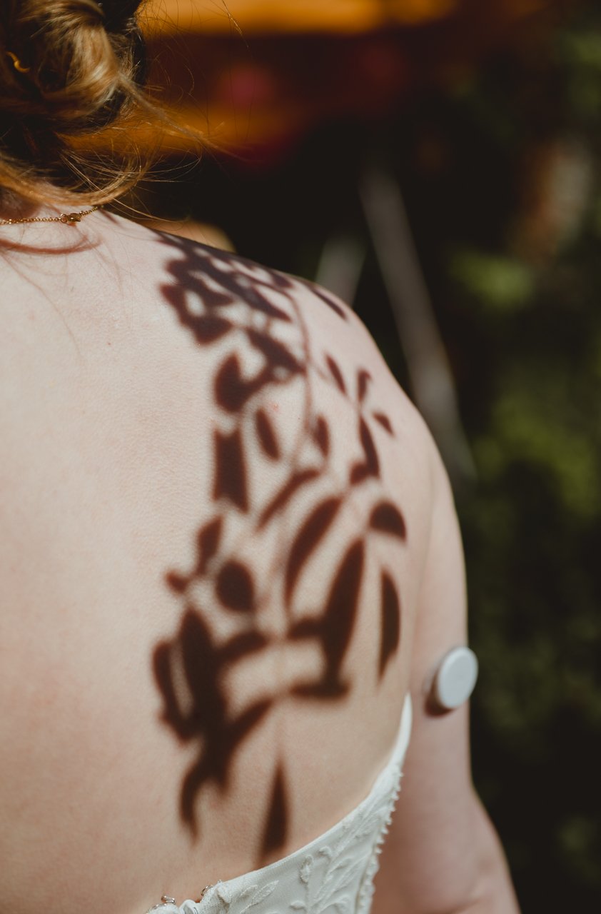Abstract editorial leaf shadow against brides back with diabetic libre at Chaucer Barn Holt Gresham Norfolk