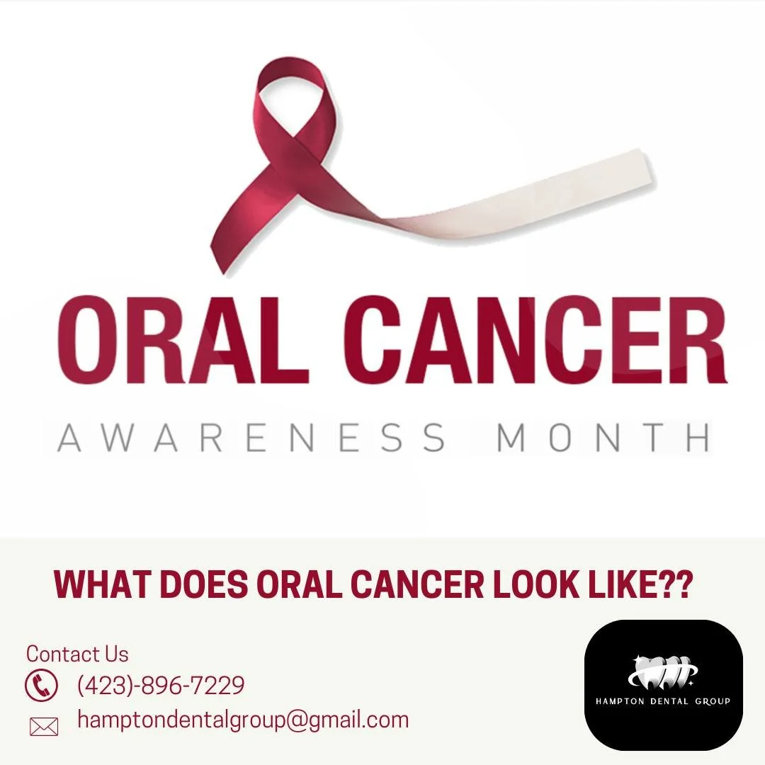 🦷 April is Oral Cancer Awareness Month 🦷

Did you know? Oral cancer can affect anyone, and early detection is key! 🚨
Know the Risks:
-Smoking or tobacco use
-Heavy alcohol consumption
-HPV (Human Papillomavirus)
-Poor oral hygiene
When to See a Do