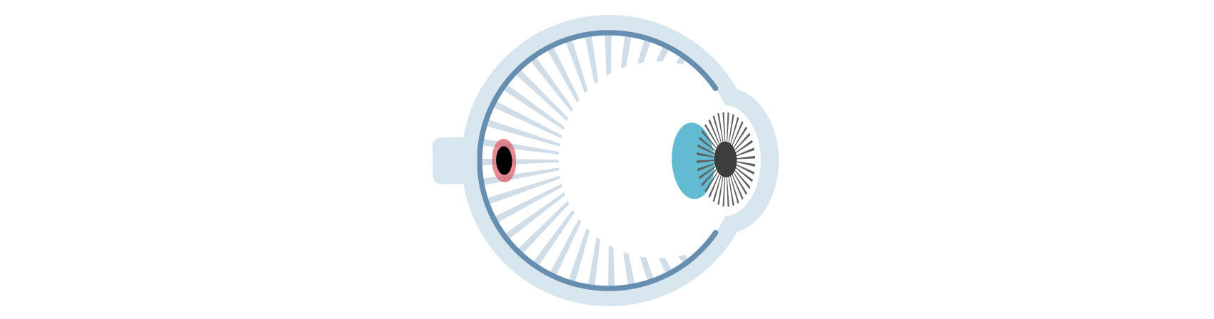 Why is gas necessary for macular hole surgery?