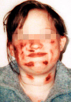 JW Foster Mother Guilty of Sadistic Abuse