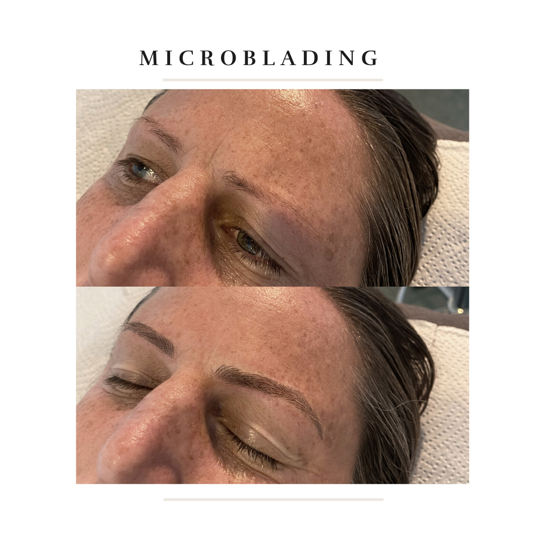 Healed after 1 year-8.png