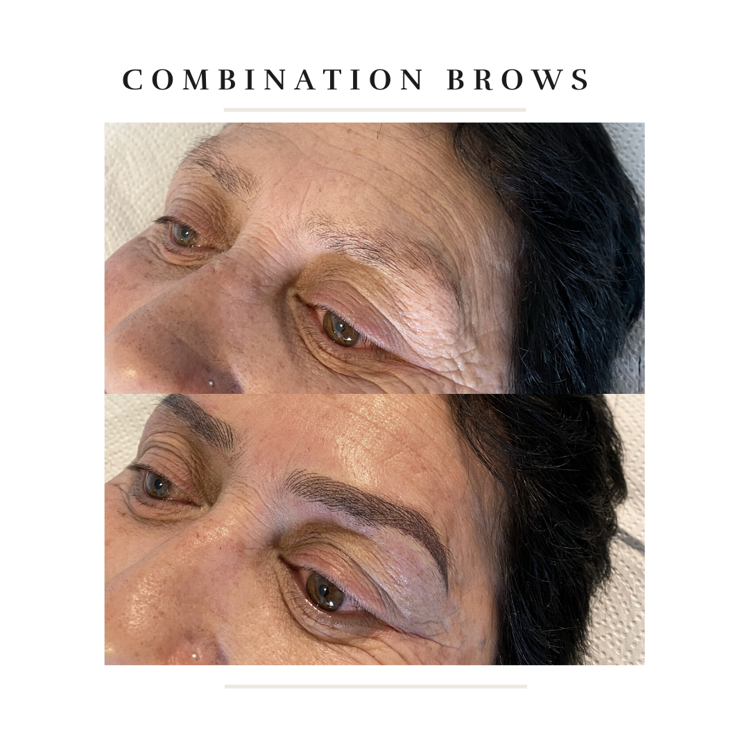 Healed after 1 year-6.png