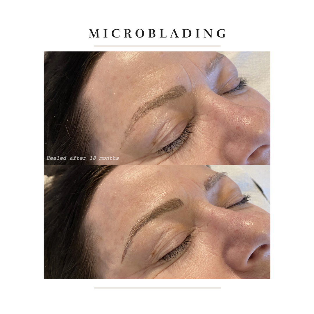 Healed after 1 year-3.png