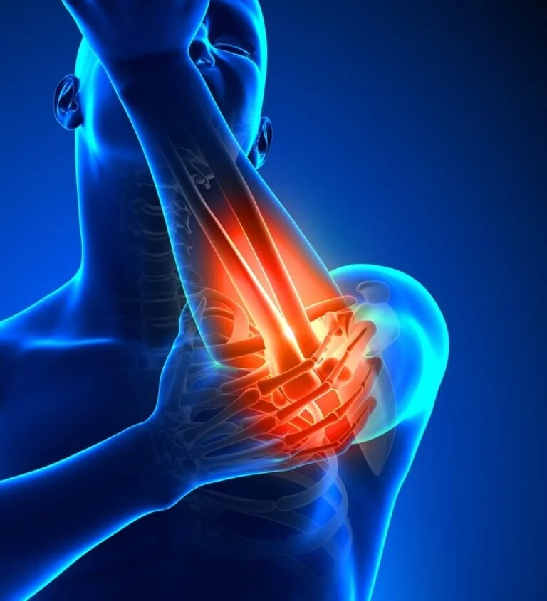 Tennis Elbow Treatment in Bangkok: A Physiotherapy Approach That Works