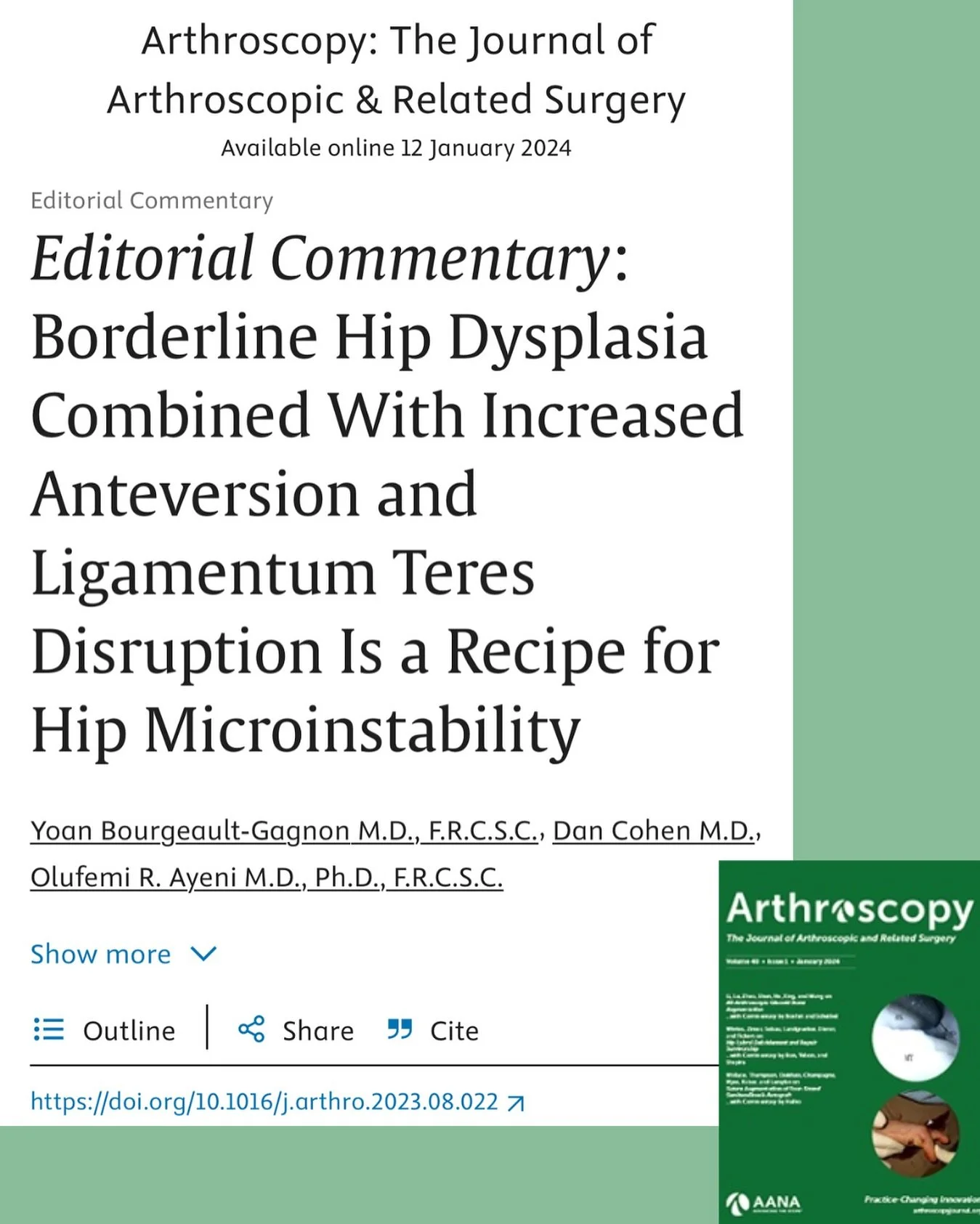 Fresh off the press: See our latest expert commentary on diagnosing patients with hip microinstability. Always maintain a high index of suspicion in the presence of borderline dysplasia and ligamentum teres tears!

🔗 in bio!
