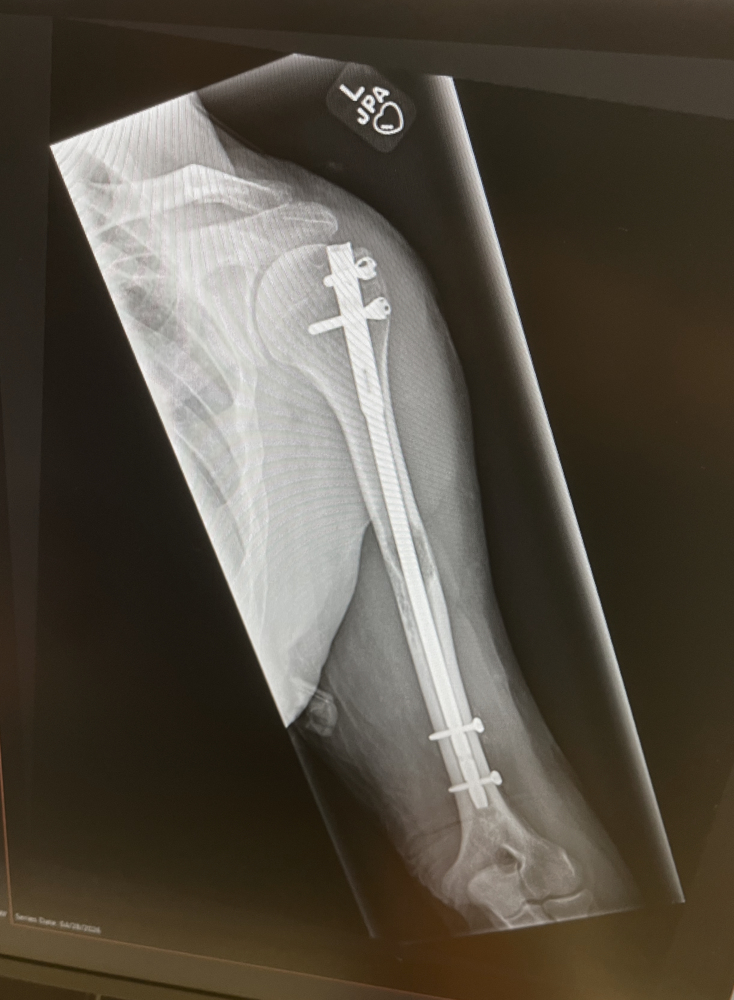 humerus.png