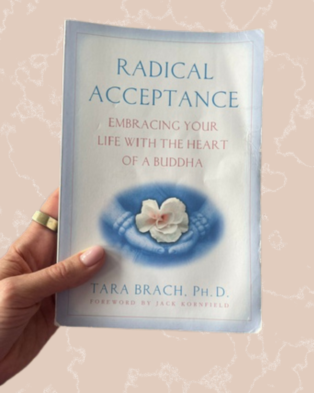 Radical Acceptance