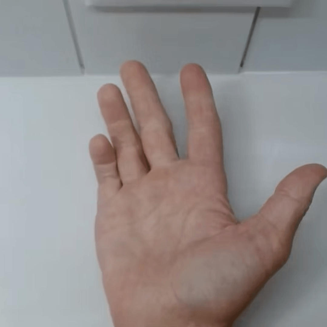 Bridgeflex splint off.png