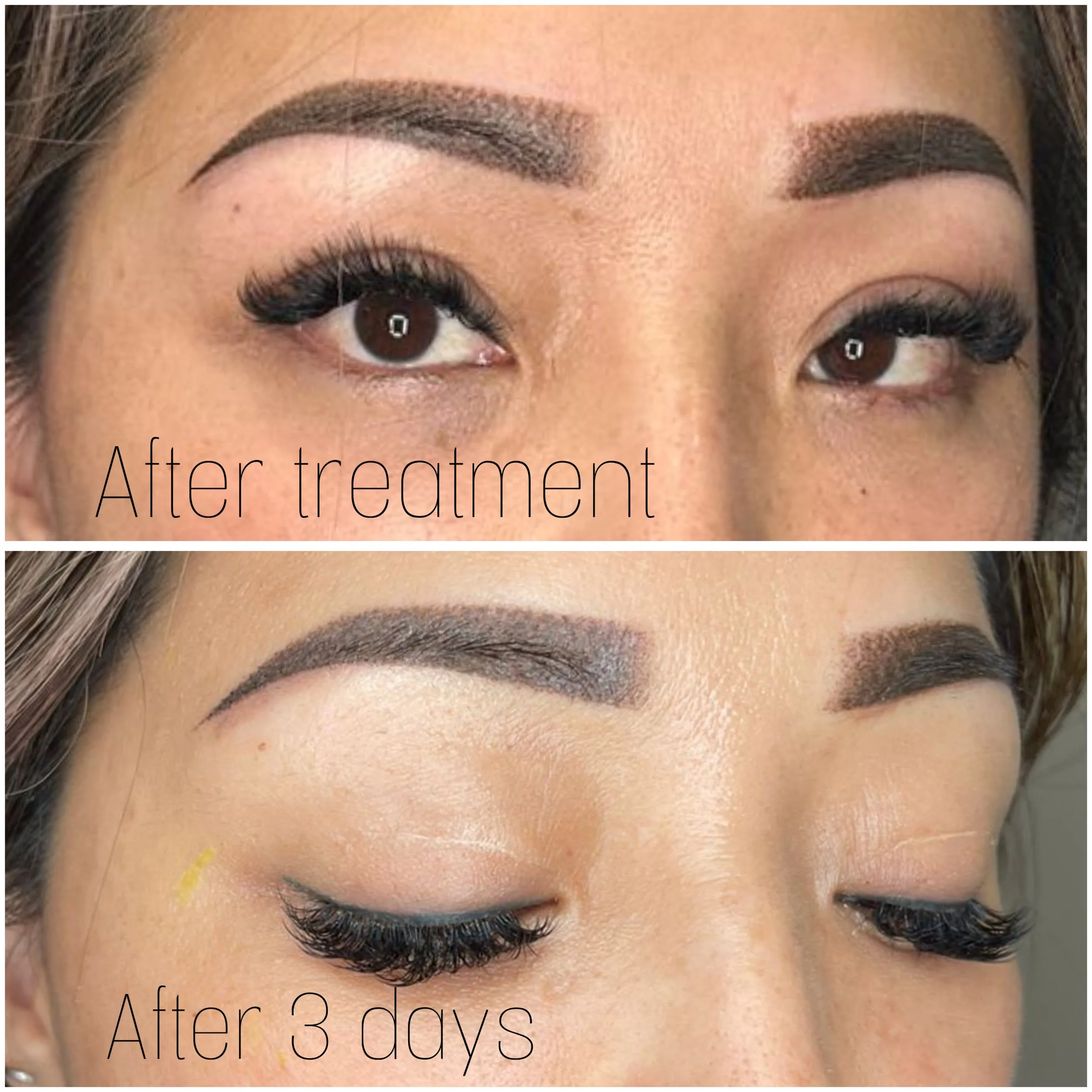 Chân mày sau 3 ngay.jpg