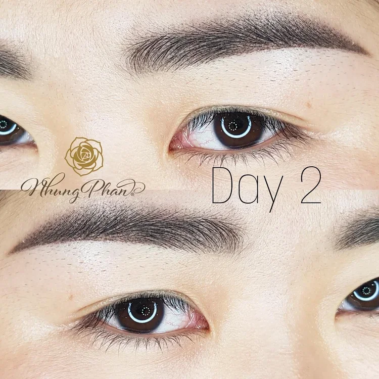 Brows