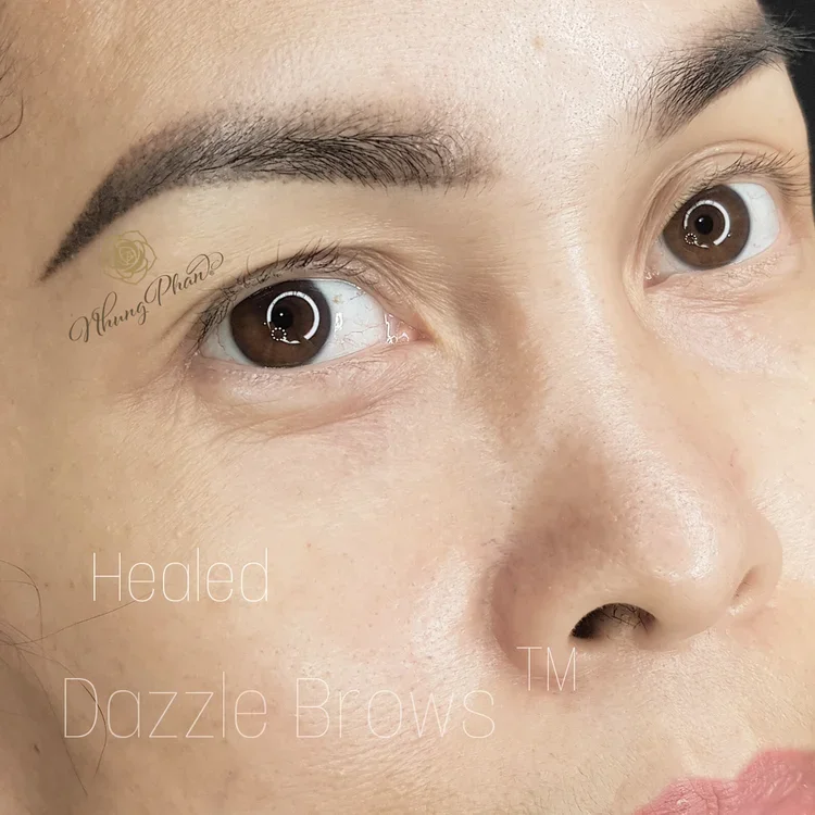Brows