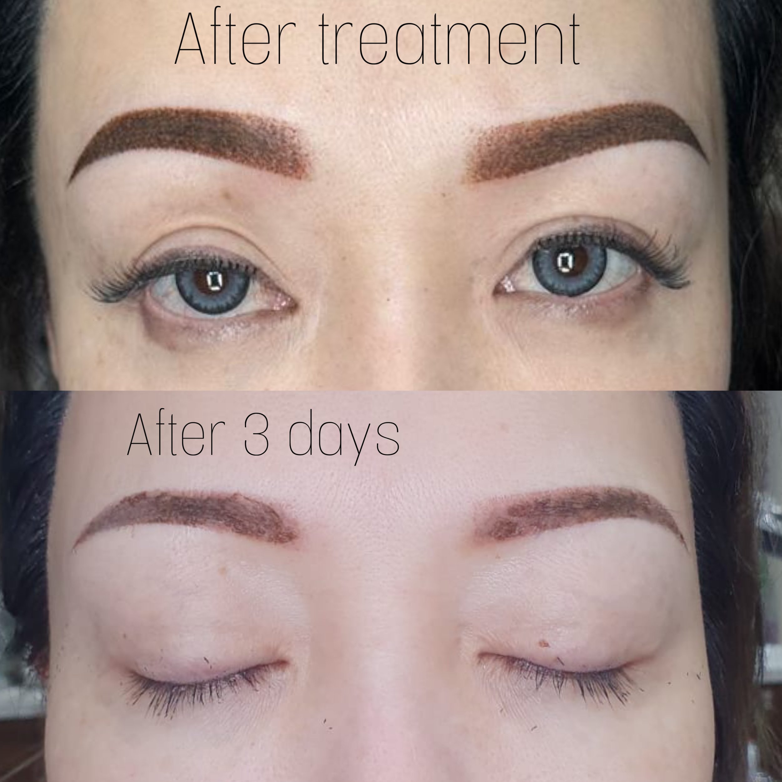 Chân mày sau 3 ngày.jpg