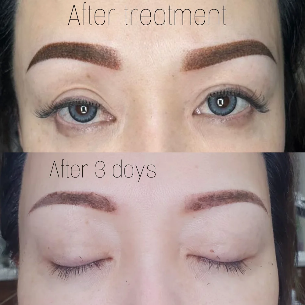 Brows