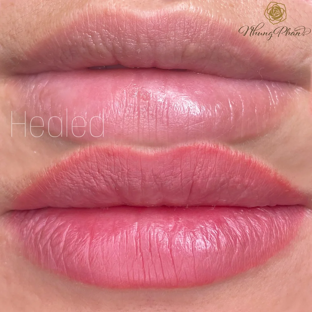 Lips