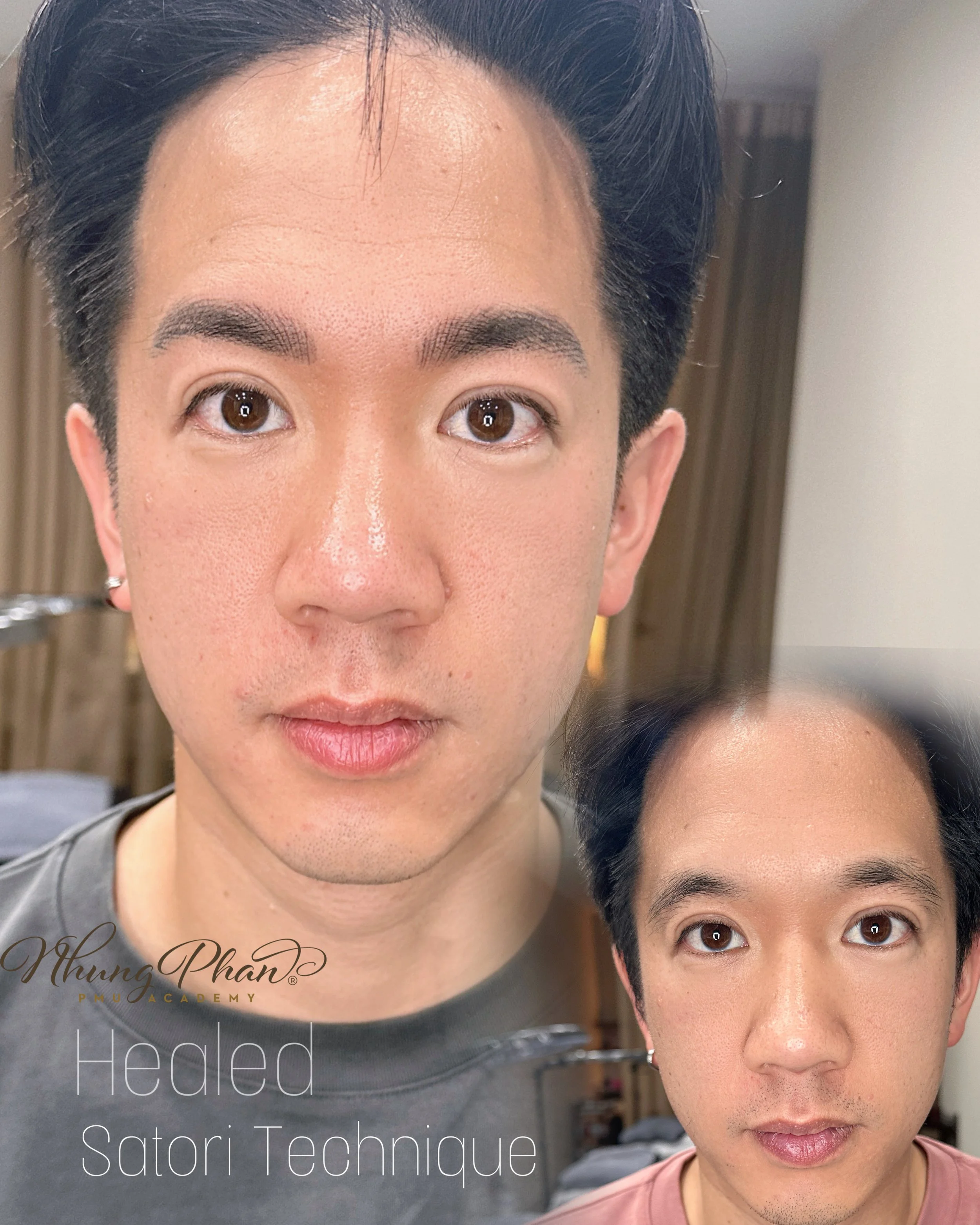 Satori technique for men healed after 2 weeks.jpg