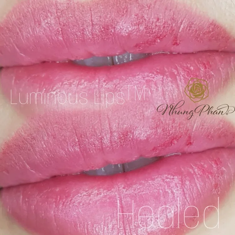 Lips