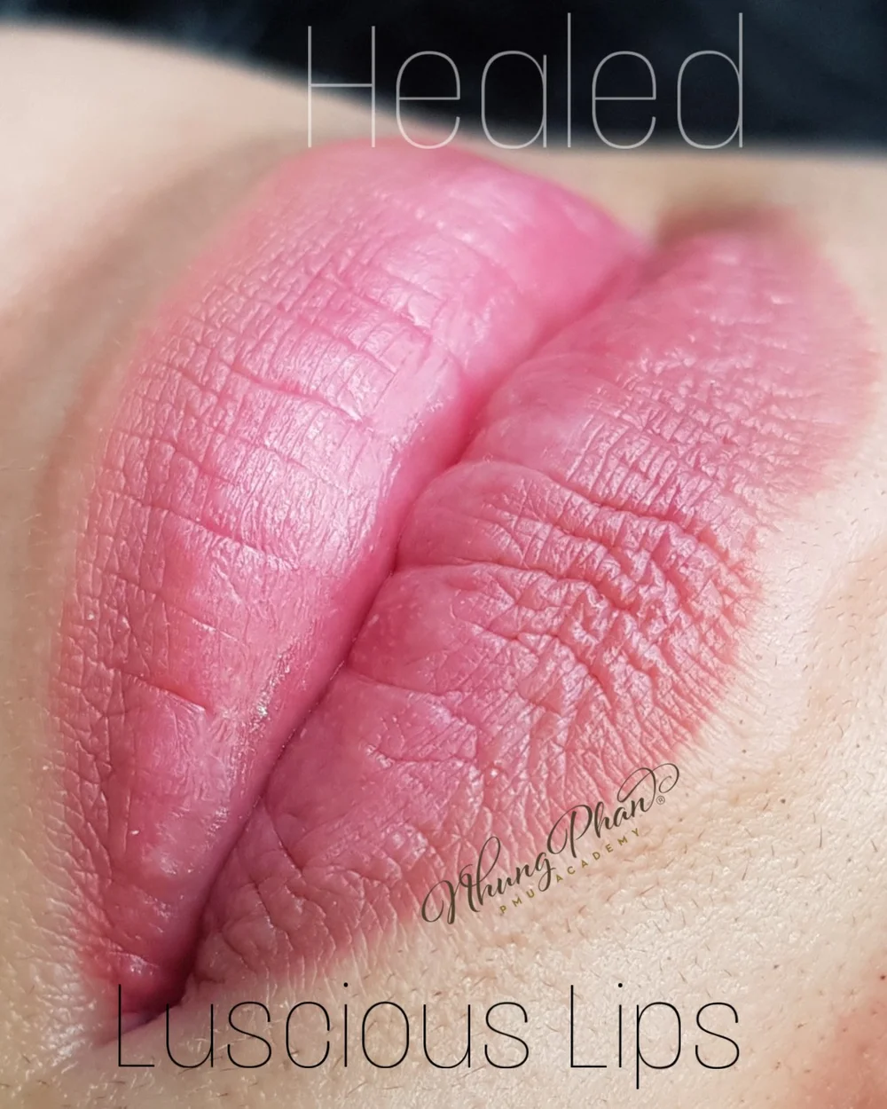 Lips