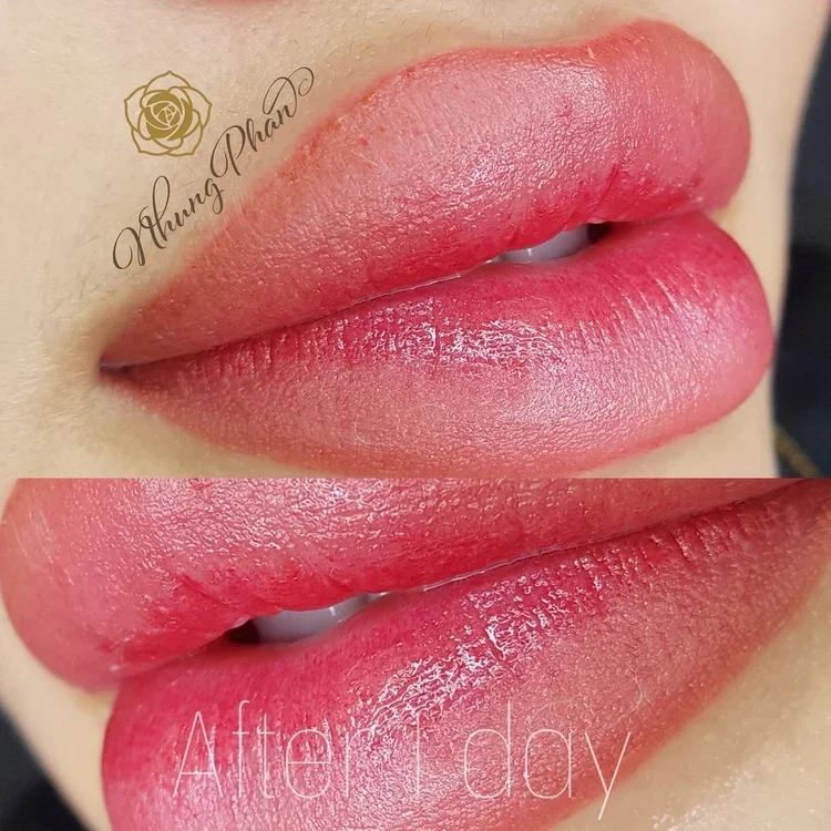 Lips